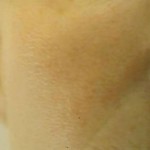 009 009